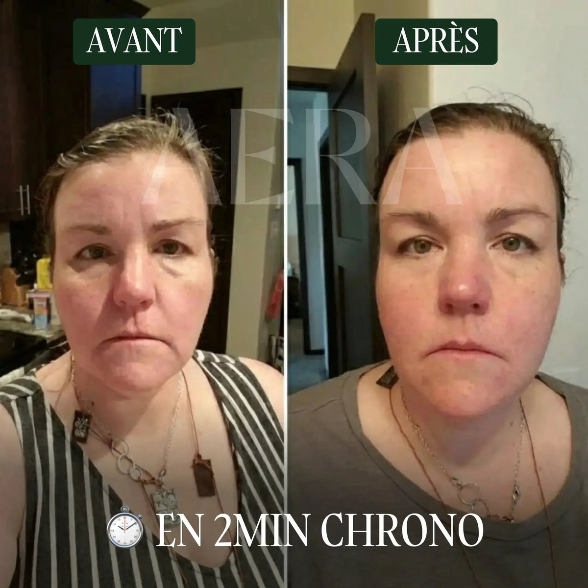Brosse lymphatique visage AERA